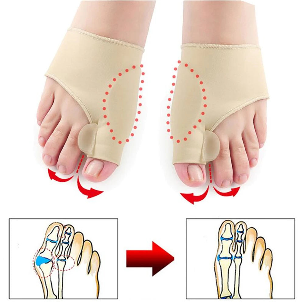 Pair Bunion Corrector Toe Straightener
