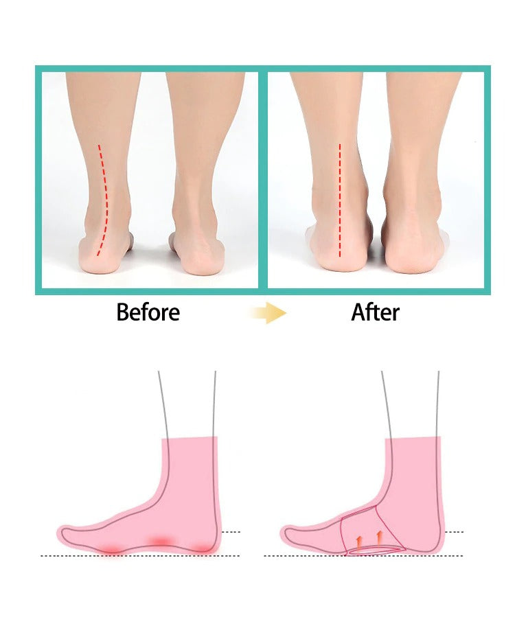 Silicone Arch Support Insoles | Foot Comfort