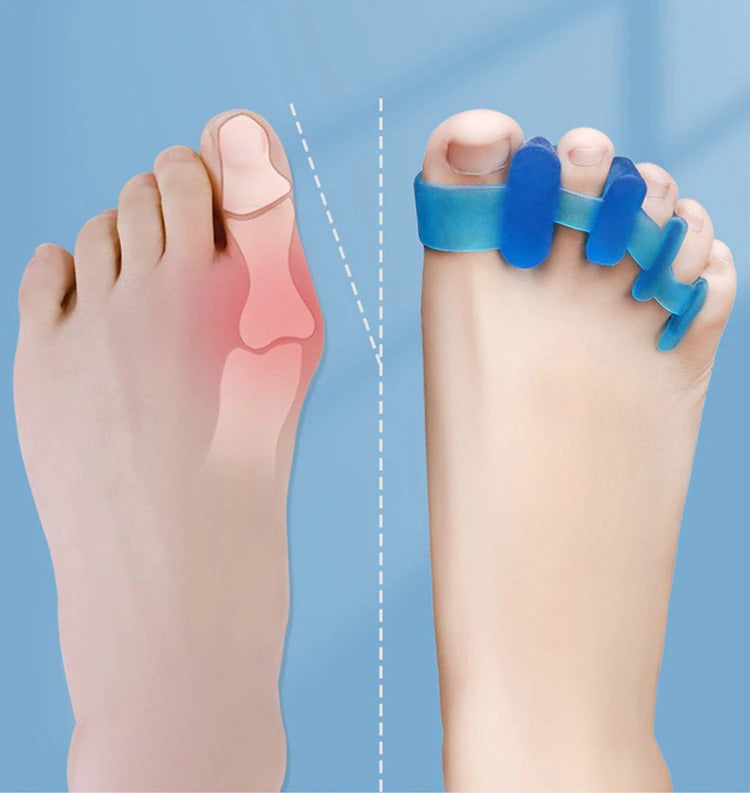 Foot & Posture Toe Separators | SEBS Comfort